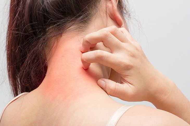      Hoe u om te gaan met atopische huid? Methoden voor behandeling van droge en jeukende huid